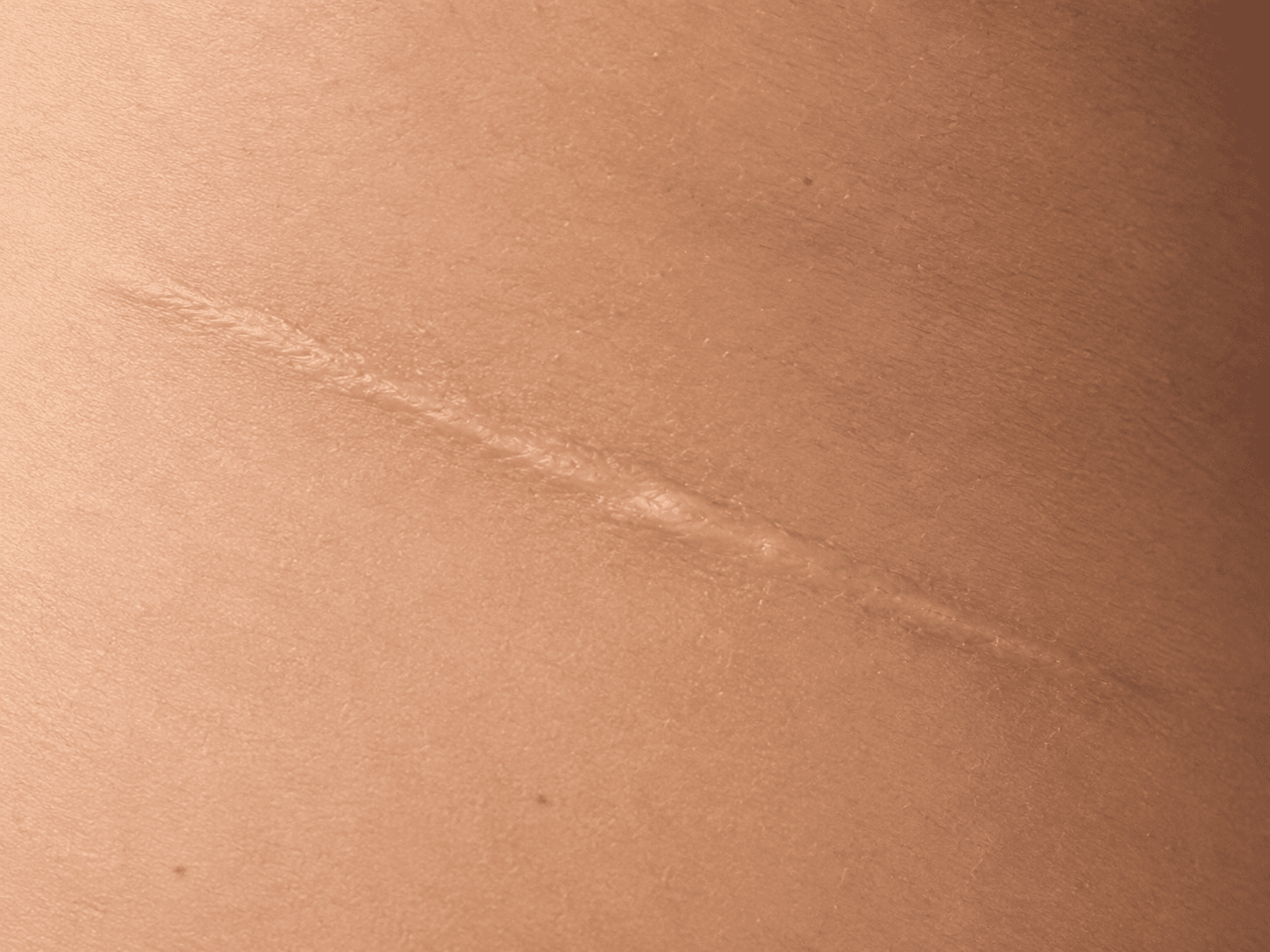 Every Scar Is a Sign of Survival